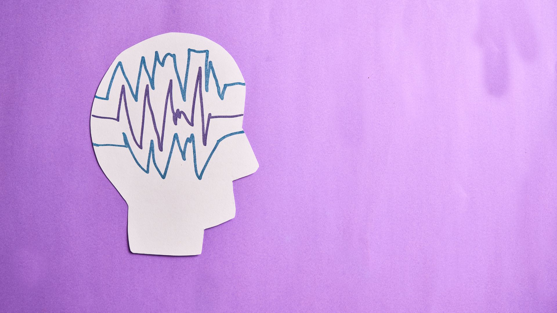 The Neuroscience of Decision-Making: What Every Leader Should Know